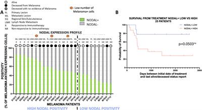 Higher Nodal expression is often associated with poorer survival in patients diagnosed with melanoma and treated with anti-PD1 therapy